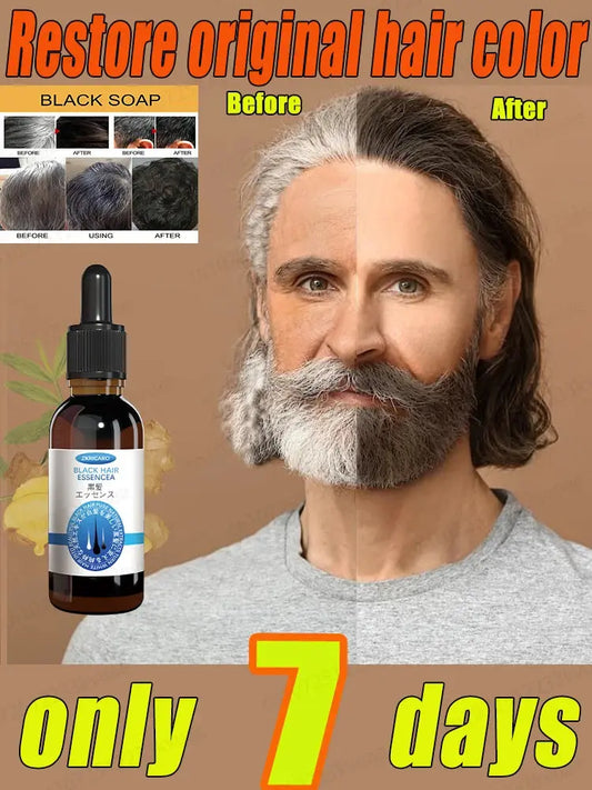 White hair killer, remove gray hair and restore natural hair color in 7 days Top Breast Beauty Flagship Store Store