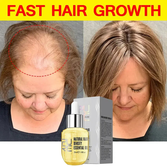 PURC Fast Hair Growth for Men Women Hair Oil Care Ginger Anti Hair Loss Scalp Treatment Grow Serum Products Beauty Health 35ml FanXiYou Cosmetic Store